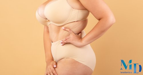 Mommy Makeover: Comprehensive Body Restoration After Pregnancy